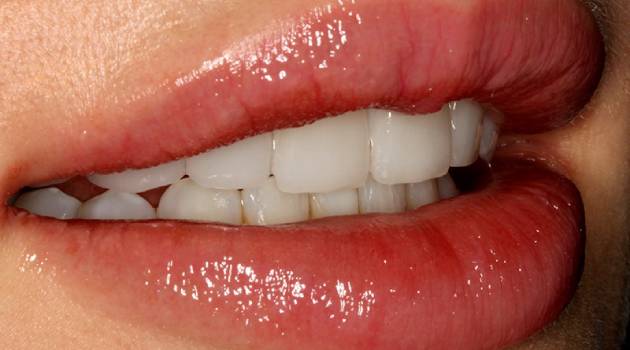 novi zubi s ljuskicama